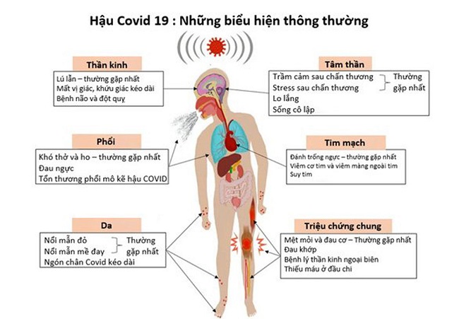 3. Viêm cơ tim ở trẻ em hậu Covid